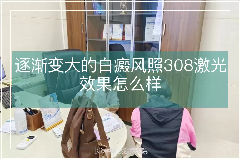 逐渐变大的白癜风照308激光效果怎么样