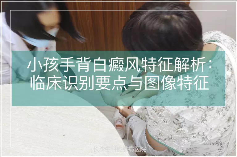 小孩手背白癜风特征解析:临床识别要点与图像特征