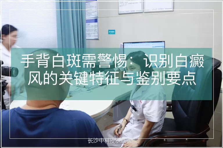 手背白斑需警惕：识别白癜风的关键特征与鉴别要点
