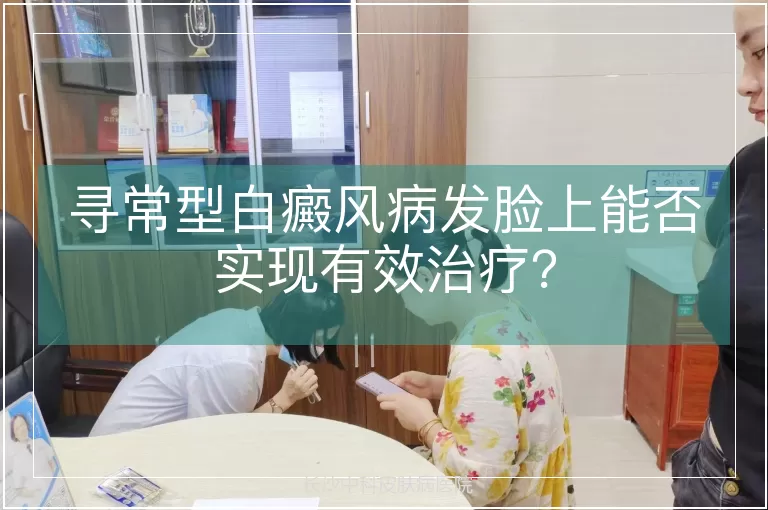 寻常型白癜风病发脸上能否实现有效治疗？
