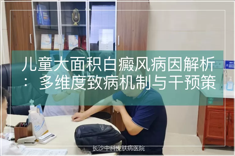 儿童大面积白癜风病因解析：多维度致病机制与干预策略