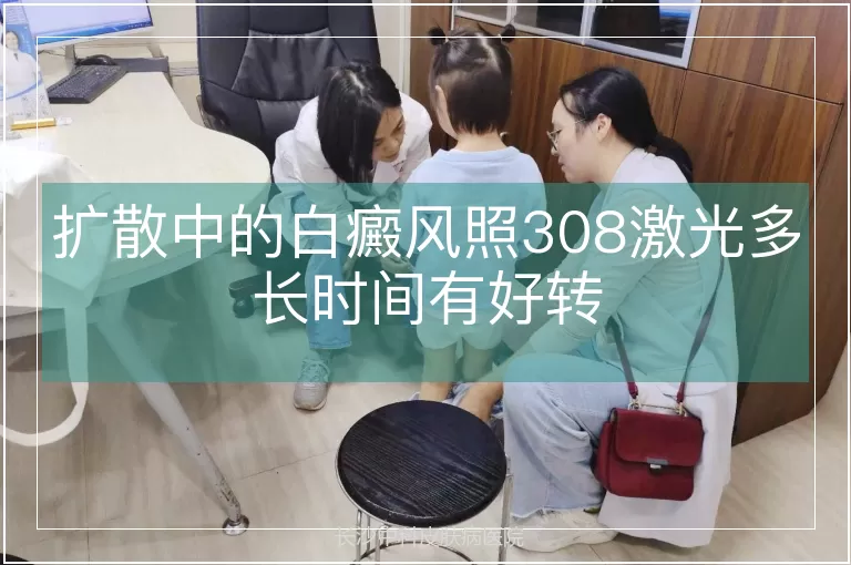 扩散中的白癜风照308激光多长时间有好转
