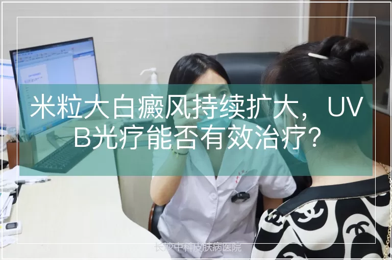 米粒大白癜风持续扩大,UVB光疗能否有效治疗?