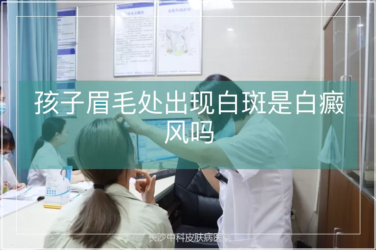 孩子眉毛处出现白斑是白癜风吗