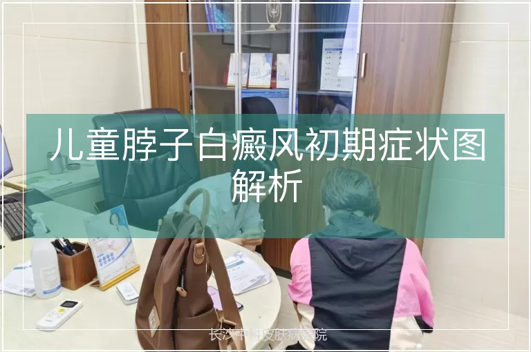 儿童脖子白癜风初期症状图解析