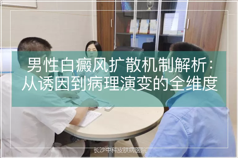 男性白癜风扩散机制解析:从诱因到病理演变的全维度探究