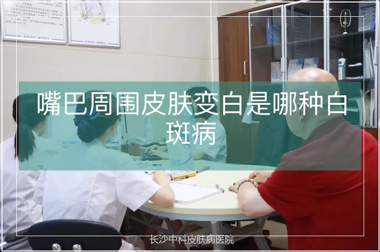 嘴巴周围皮肤变白是哪种白斑病