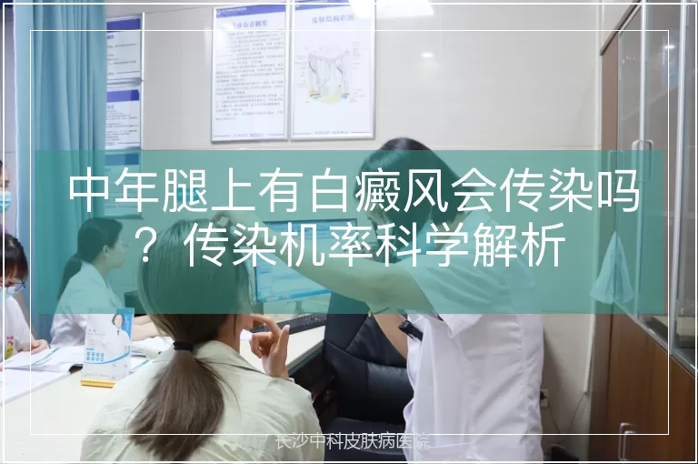 中年腿上有白癜风会传染吗？传染机率科学解析