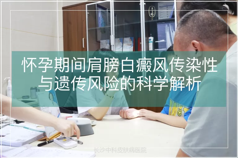 怀孕期间肩膀白癜风传染性与遗传风险的科学解析