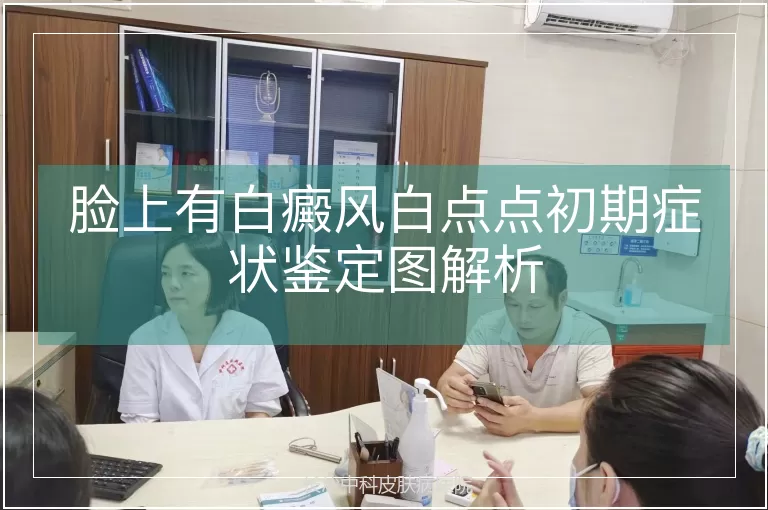 脸上有白癜风白点点初期症状鉴定图解析