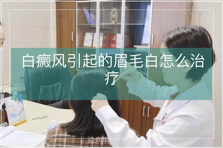 白癜风引起的眉毛白怎么治疗