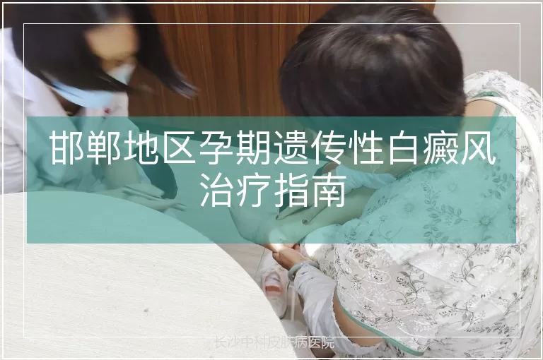 邯郸地区孕期遗传性白癜风治疗指南