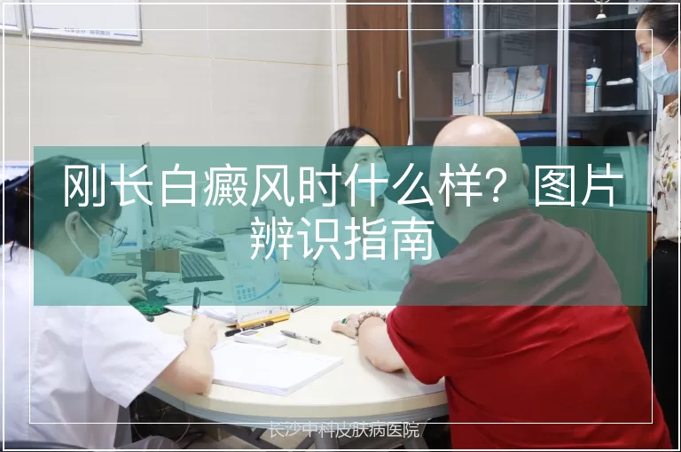刚长白癜风时什么样?图片辨识指南