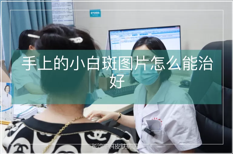 手上的小白斑图片怎么能治好
