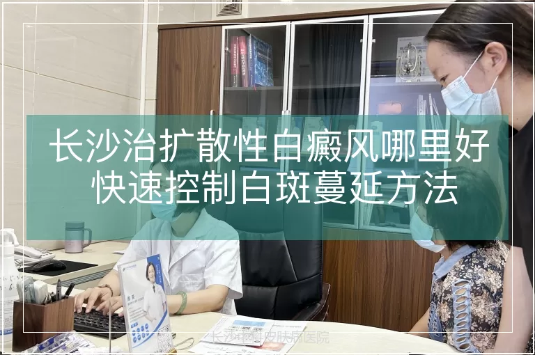 长沙治扩散性白癜风哪里好 快速控制白斑蔓延方法