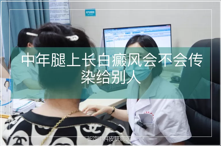 中年腿上长白癜风会不会传染给别人