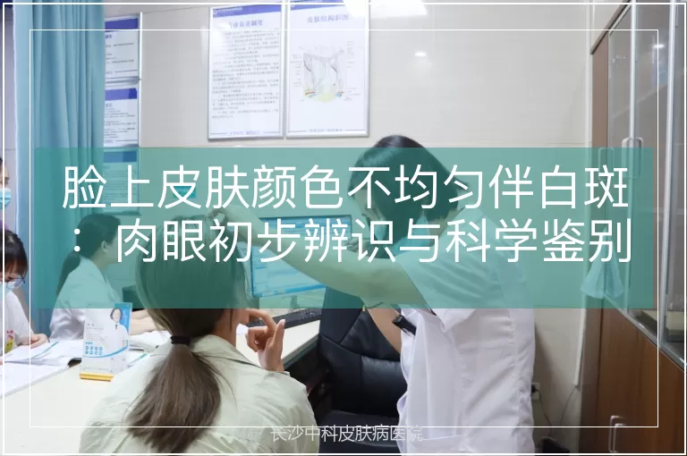 脸上皮肤颜色不均匀伴白斑：肉眼初步辨识与科学鉴别指南