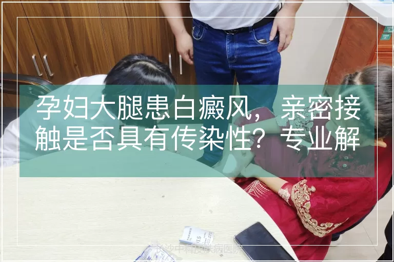孕妇大腿患白癜风，亲密接触是否具有传染性？专业解析与科学认知