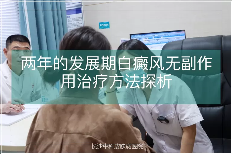 两年的发展期白癜风无副作用治疗方法探析