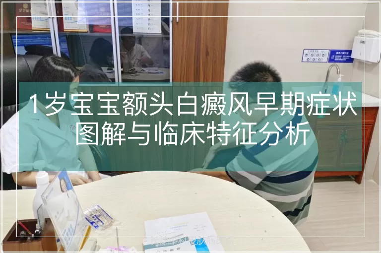 1岁宝宝额头白癜风早期症状图解与临床特征分析