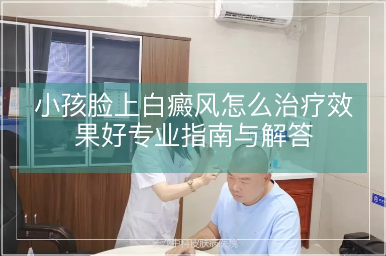 小孩脸上白癜风怎么治疗效果好专业指南与解答