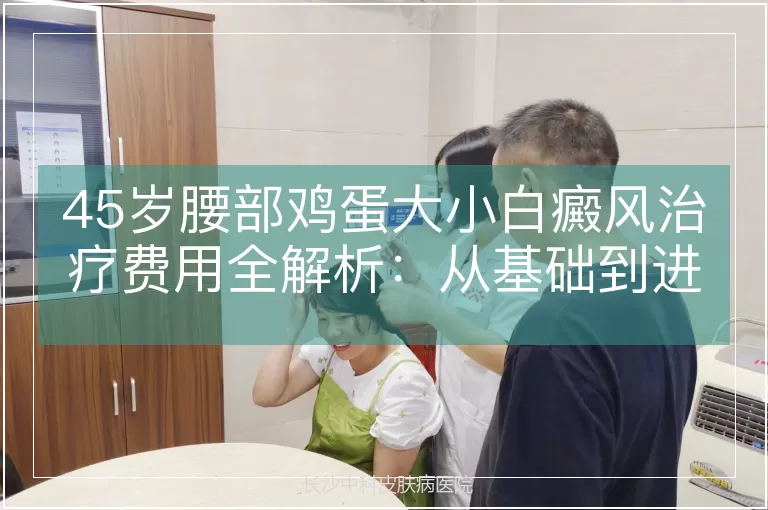 45岁腰部鸡蛋大小白癜风治疗费用全解析:从基础到进阶的精准评估