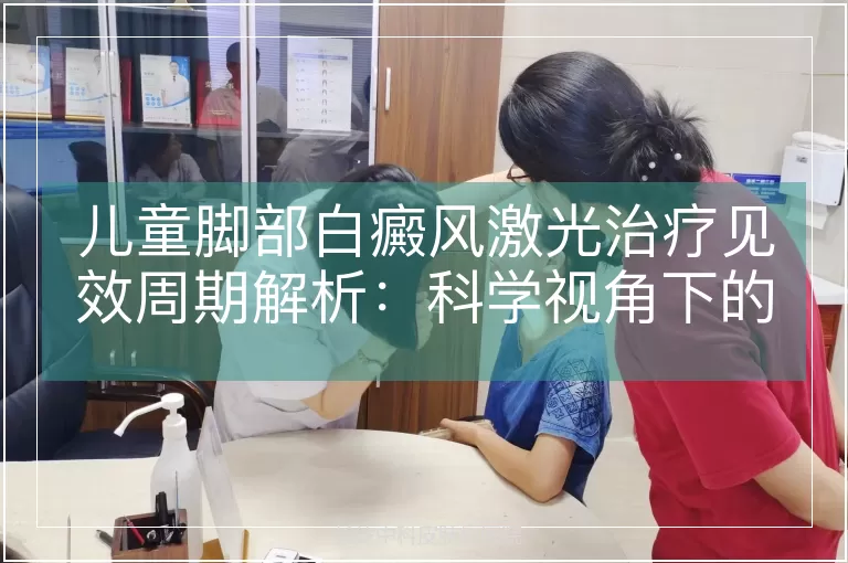 儿童脚部白癜风激光治疗见效周期解析：科学视角下的疗程管理