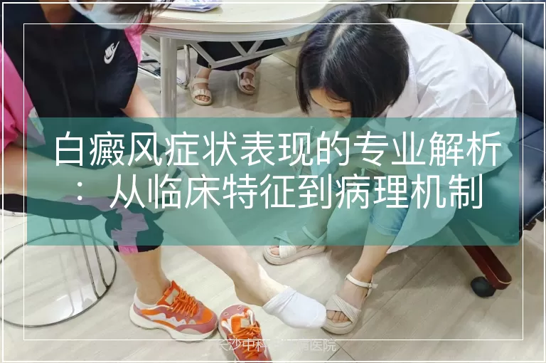 白癜风症状表现的专业解析：从临床特征到病理机制