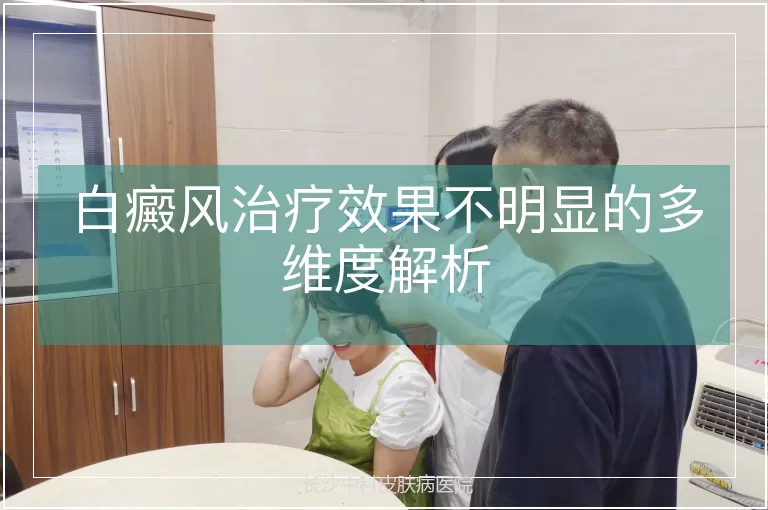 白癜风治疗效果不明显的多维度解析