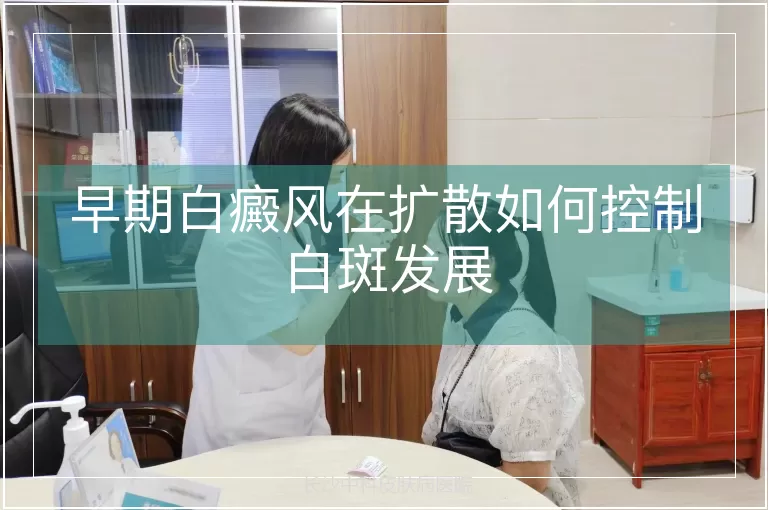 早期白癜风在扩散如何控制白斑发展