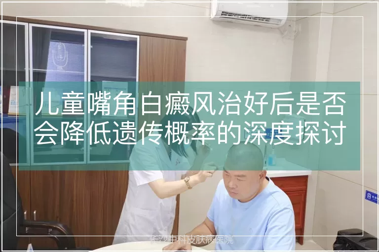 儿童嘴角白癜风治好后是否会降低遗传概率的深度探讨