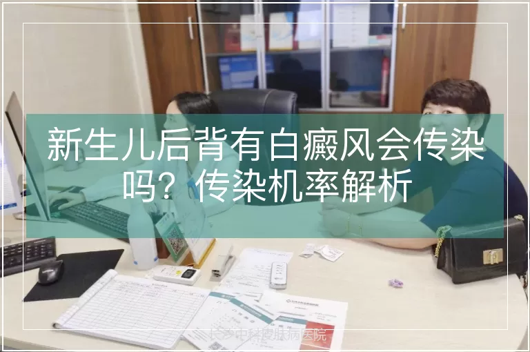 新生儿后背有白癜风会传染吗？传染机率解析