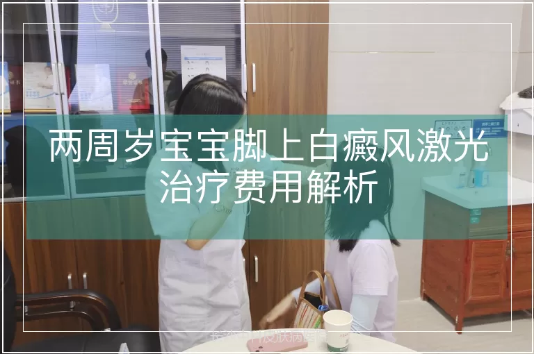 两周岁宝宝脚上白癜风激光治疗费用解析