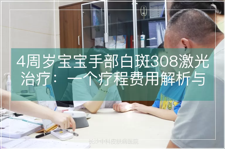4周岁宝宝手部白斑308激光治疗：一个疗程费用解析与关键影响因素