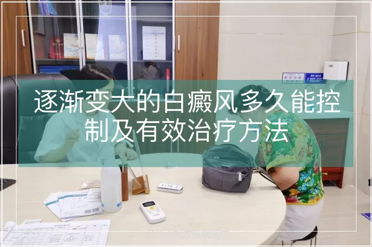 逐渐变大的白癜风多久能控制及有效治疗方法