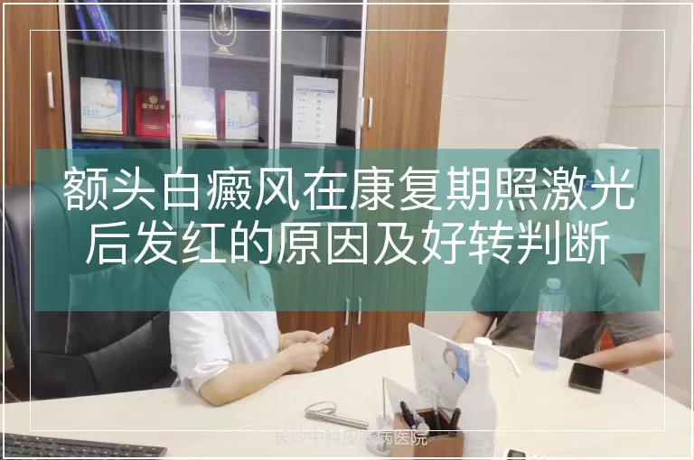 额头白癜风在康复期照激光后发红的原因及好转判断