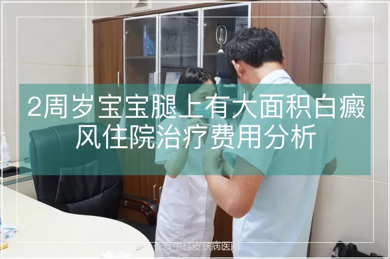 2周岁宝宝腿上有大面积白癜风住院治疗费用分析