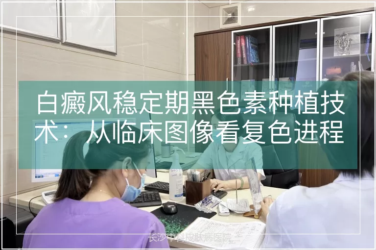 白癜风稳定期黑色素种植技术：从临床图像看复色进程与科学管理