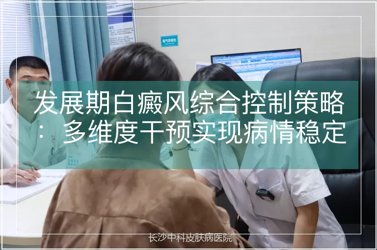 发展期白癜风综合控制策略：多维度干预实现病情稳定