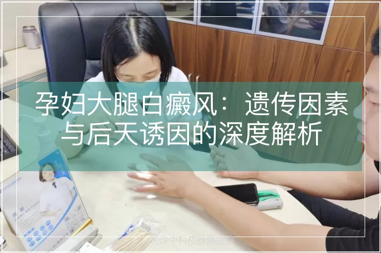 孕妇大腿白癜风：遗传因素与后天诱因的深度解析