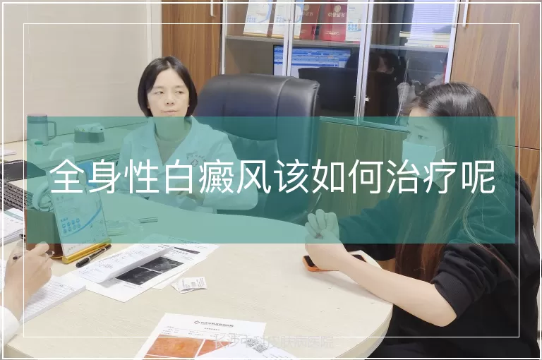 全身性白癜风该如何治疗呢