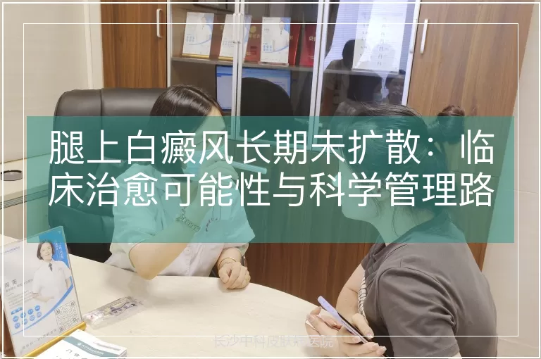 腿上白癜风长期未扩散：临床治愈可能性与科学管理路径