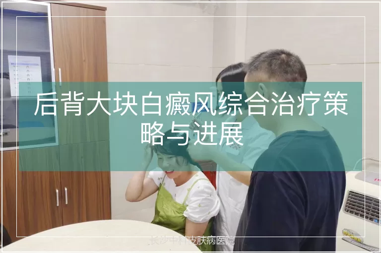 后背大块白癜风综合治疗策略与进展