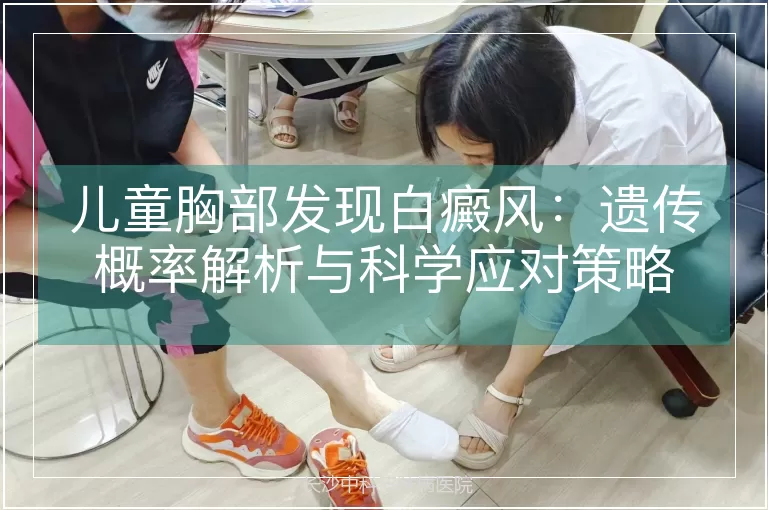 儿童胸部发现白癜风：遗传概率解析与科学应对策略