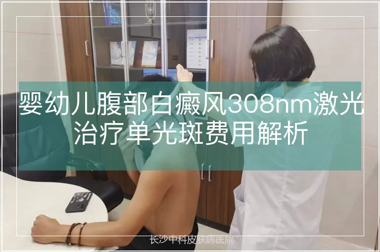 婴幼儿腹部白癜风308nm激光治疗单光斑费用解析