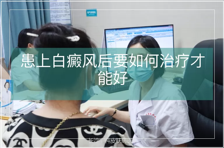 患上白癜风后要如何治疗才能好