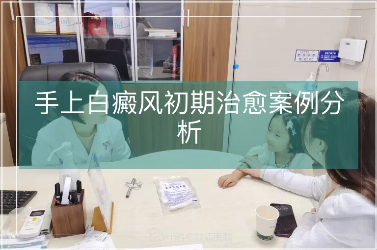 手上白癜风初期治愈案例分析