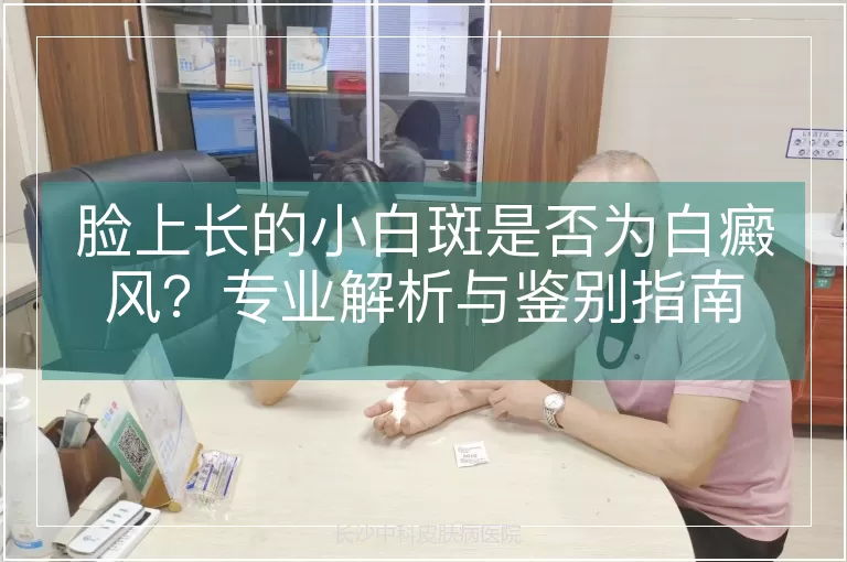 脸上长的小白斑是否为白癜风？专业解析与鉴别指南
