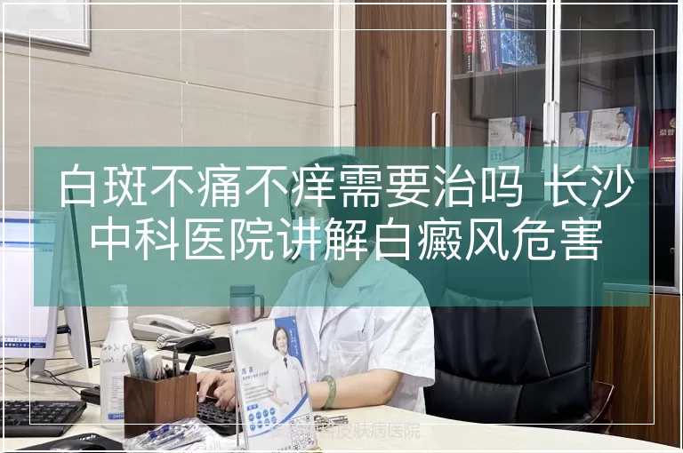 白斑不痛不痒需要治吗 长沙中科医院讲解白癜风危害