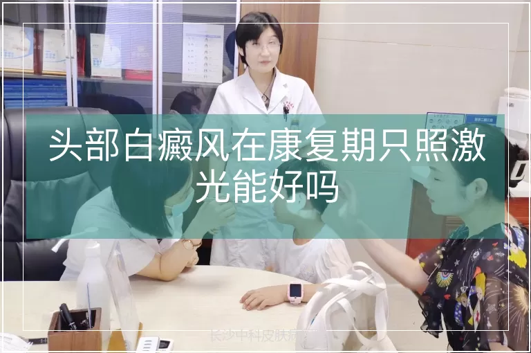 头部白癜风在康复期只照激光能好吗